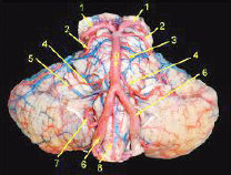 Bagian batang otak dalam dan pembuluh darah yang memperdarahinya