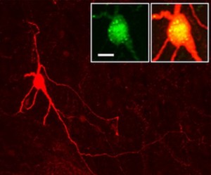 Neuron Pada Hippothalamus yang menyandi MCh sebagai faktor penentu kualitas tidur