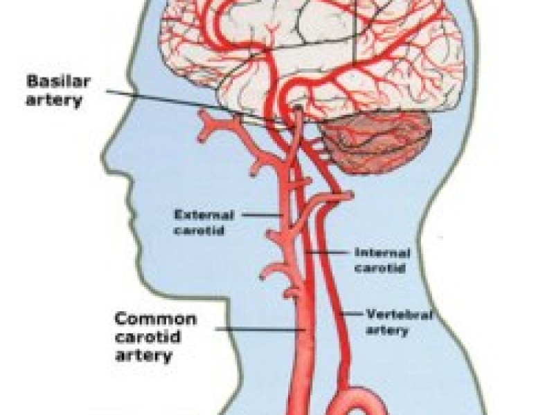 Anterior cerebral artery. Как поступает кровь в головной мозг.